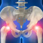 Creato l'osso bionico autorigenerante che si stampa in 3D