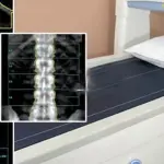 Giornata mondiale osteoporosi, quali sono i messaggi fuorvianti